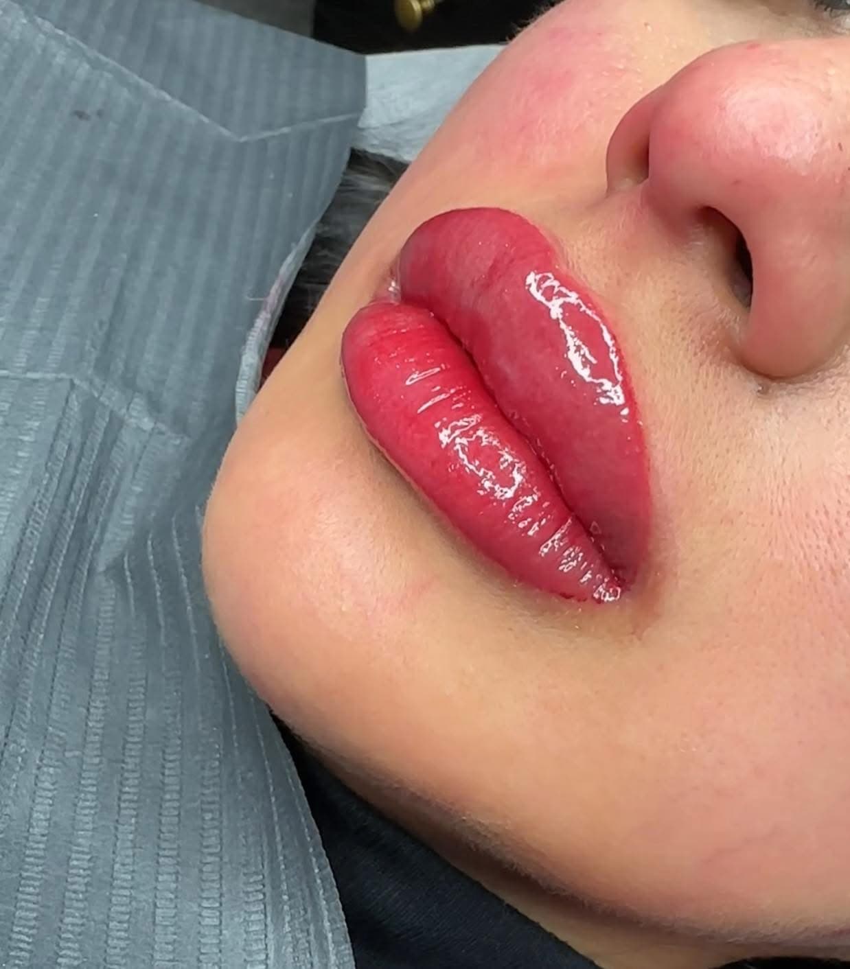 Close-up of vibrant, glossy red lips with a defined shape following a cosmetic enhancement procedure.